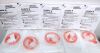 MEDELA ENF060182LD Enteral Extension Set 60” Orange Striped MiniBore Tubing ENFit  #N1 (LOT/15) 2024/08