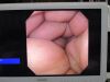 OLYMPUS GIF-P140 Gastroscope