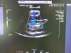 SIEMENS Acuson SC2000 Ultrasound Machine