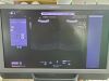 SIEMENS Acuson SC2000 Ultrasound Machine
