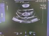 SIEMENS Acuson SC2000 Ultrasound Machine