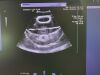 SIEMENS Acuson SC2000 Ultrasound Machine