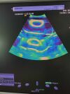 SIEMENS Acuson SC2000 Ultrasound Machine