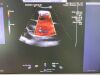 SIEMENS Acuson SC2000 Ultrasound Machine