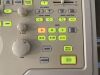 ALOKA SSD-1400 Ultrasound - Shared Service