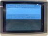 SIEMENS SONOLINE G20 ULTRASOUND W/ PRINTER @