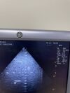 GE ultrasonic transducer New ultrasound transducer Ultrasound Accessories