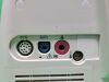 PHILIPS SureSigns VM6 Patient Monitor