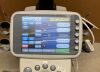ULTRASONIX SonixTouch Ultrasound - Vascular - Small Parts