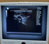ULTRASONIX SonixTouch Ultrasound - Vascular - Small Parts