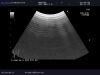 ALOKA UST-995-7.5 Ultrasound Transducer
