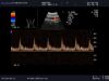 ALOKA UST-995-7.5 Ultrasound Transducer