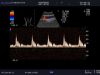 ALOKA UST-9120 Ultrasound Transducer