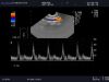 ALOKA UST-9124 Ultrasound Transducer