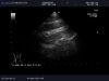 ALOKA UST-52114P Ultrasound Transducer