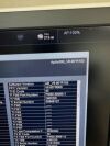 TOSHIBA aplio 300 platinium Ultrasound - OB / GYN - Vascular