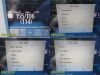 PHILIPS Intellivue MP50 Critical Care , W/ MMS Print IBP &CO Modules~ Monitor