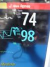 PHILIPS Intellivue MP50, W/ MMS PRINT IBP CO MODULES & NEW LEADS ~ Monitor