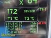 GE Dash 4000 MULTI-PARA, CO2 IBP NBP ECG TEMP Masimo SPO2 & Print~ Monitor