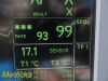 GE Dash 4000 MULTI-PARA, CO2 IBP NBP ECG TEMP Masimo SPO2 & Print~ Monitor