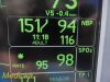 GE Dash 4000 MULTI-PARA, CO2 IBP NBP ECG TEMP Masimo SPO2 & Print~ Monitor