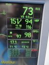 GE Dash 4000 MULTI-PARA, CO2 IBP NBP ECG TEMP Masimo SPO2 & Print~ Monitor