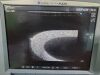 SONOSITE Micromaxx P08840-020 Portable Ultrasound Machine