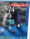 PHILIPS Intellivue MP50 Critical Care Patient Monitor