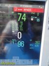 PHILIPS Intellivue MP50 Critical Care Monitor