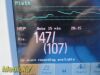 PHILIPS Intellivue MP50 Patient Monitor