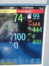 PHILIPS Intellivue MP50 Multiparemeter Patient Monitor