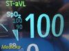 PHILIPS Intellivue MP50 Multiparemeter Patient Monitor