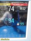 PHILIPS Intellivue MP50 Critical Care Patient Monitor