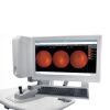 CARL ZEISS Clarus 500 Fundus Camera