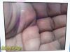 STRYKER ENDOSCOPY AIM Camera Head 18mm Coupler Ref 1588-020-122, TESTED