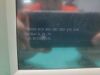 PHILIPS Intellivue MP30 Patient Monitor