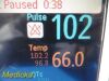 PHILIPS Intellivue MP50 Anesthesia Patient Monitor