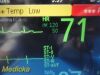 PHILIPS Intellivue MP50 Anesthesia Patient Monitor