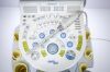 HITACHI Hi Vision Avius Ultrasound