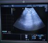 GE HEALTHCARE RAB6-D ultrasound probe Ultrasound Transducer