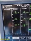 GE Dash 4000,(CO,NBP,ECG,TEMP,Masimo SPO2) W/ NEW Leads ~  Patient Monitor