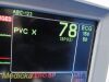 GE Dash 5000 ,(IPB, NBP, ECG, SpO2, TEMP) W/ NEW Leads ~ Patient Monitor