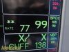 GE Dash 5000 ,(IPB, NBP, ECG, SpO2, TEMP) W/ NEW Leads ~ Patient Monitor