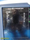 GE Dash 5000,(IPB, NBP, ECG, SpO2 Masimo , TEMP CO2 ) W/ Leads ~ Monitor