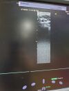 SIEMENS Acuson SC2000 Ultrasound Machine