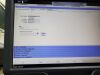 SIEMENS Acuson SC2000 Ultrasound Machine