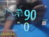 PHILIPS Intellivue MP50 Critical Care Patient Monitor