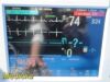 PHILIPS Intellivue MP50 Critical Care Patient Monitor