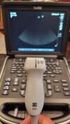 SONOSITE Edge Ultrasound - Vascular - Small Parts