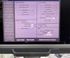 ACUSON/SIEMENS Siemens Acuson S3000 Ultrasound Machine